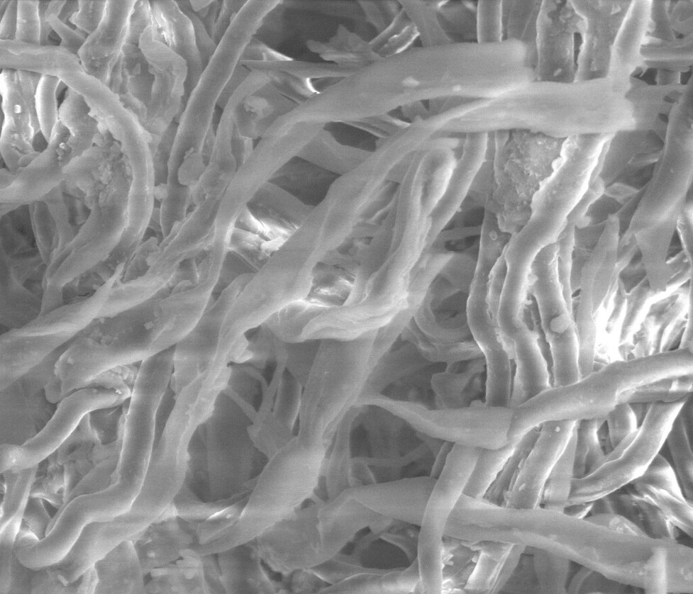 Scanning electron micrograph of a dense fibre network